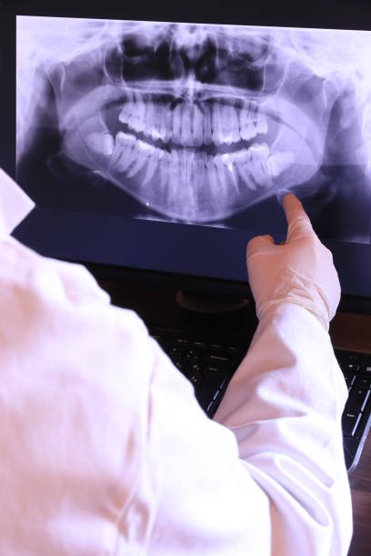 Best Emergency Root Canal Treatment in Liolnton, NC
