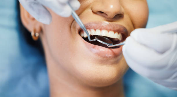 Best Same-Day Emergency Dentist in Liolnton, NC