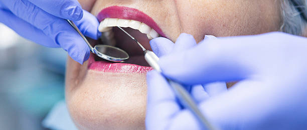 Best Emergency Broken Tooth Repair in Liolnton, NC